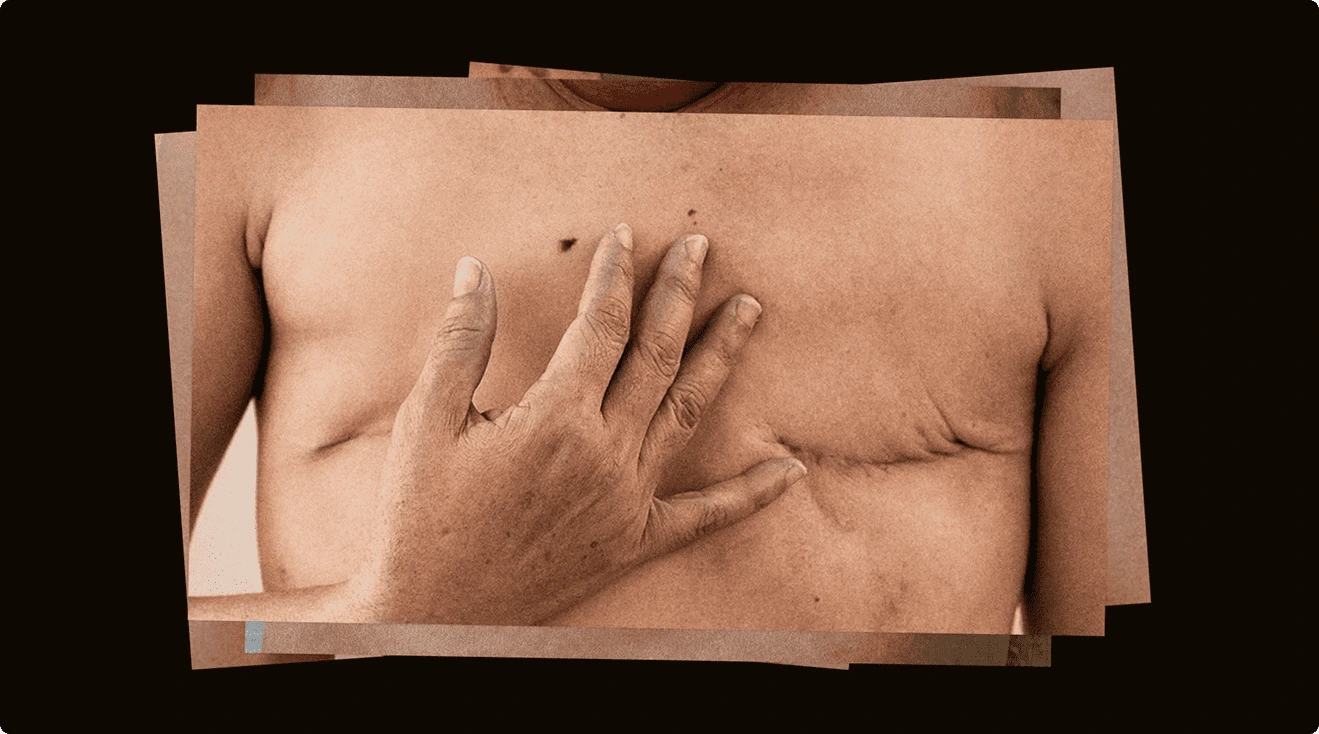 Polluted Mark Case Film